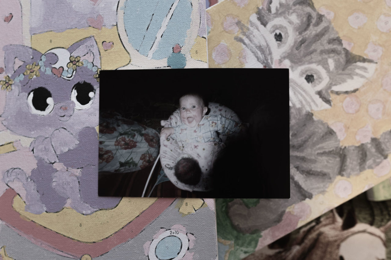 Фото из архива семьи Шестак. Юле около года, на лице малышки заметны пятна